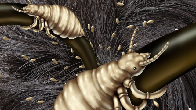 Ako sa zbavi� v�� a hn�d?